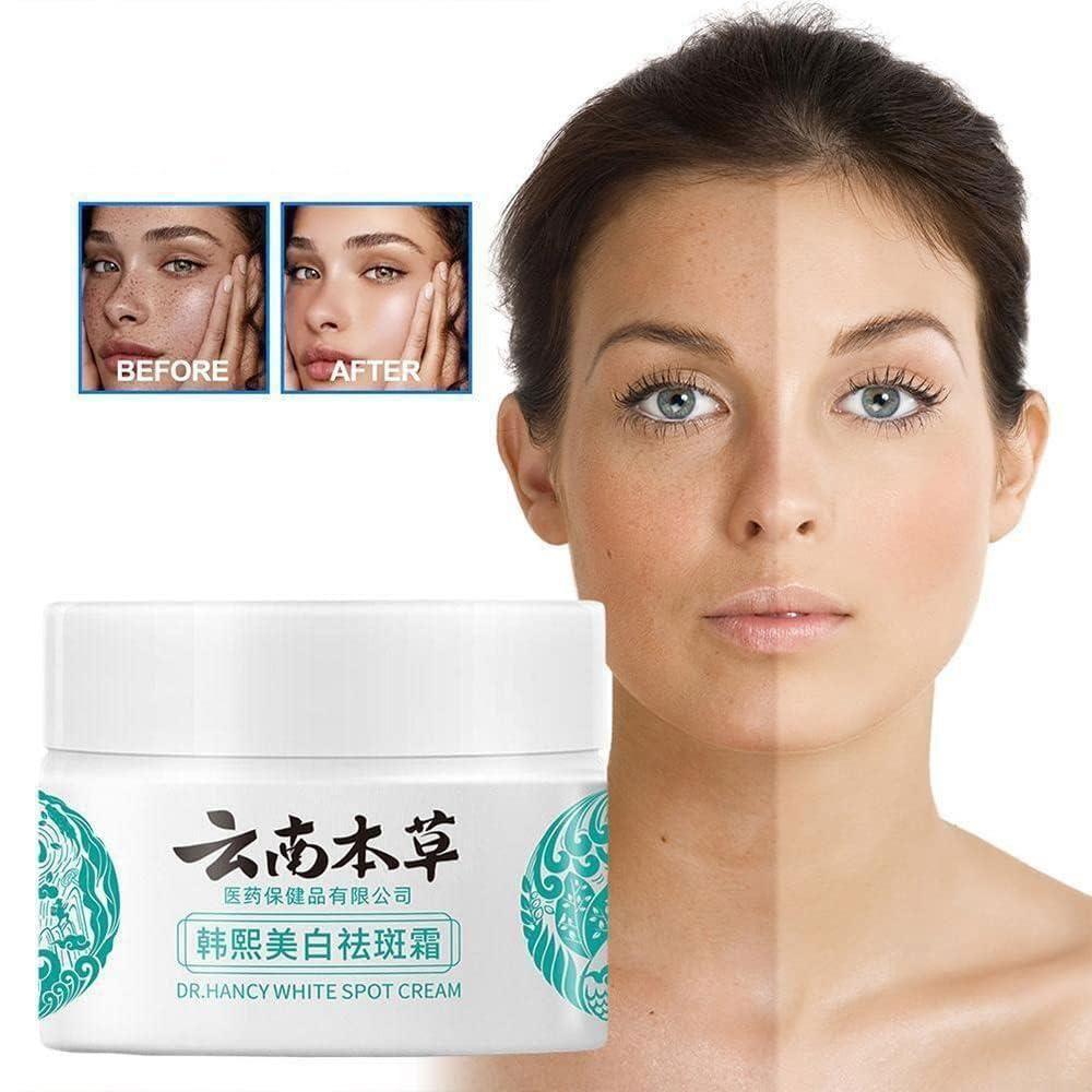 Japanese Melasma Cream - gearot